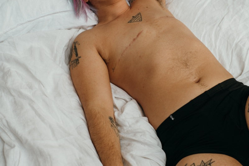 Une personne ayant subi une mastectomie est allongée sur un lit et porte un boxer noir.
